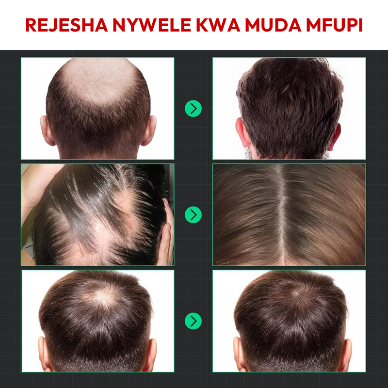 Hair Treatment 100% Natural