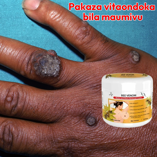 Warts Removal Cream 100% Natural