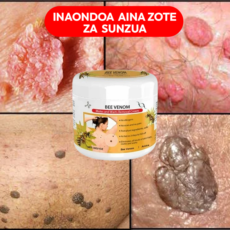 Warts Removal Cream 100% Natural