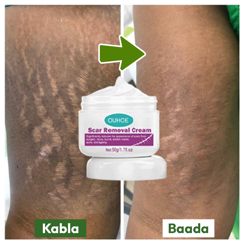 Scar Removal Cream 100% Natural + Guarantee