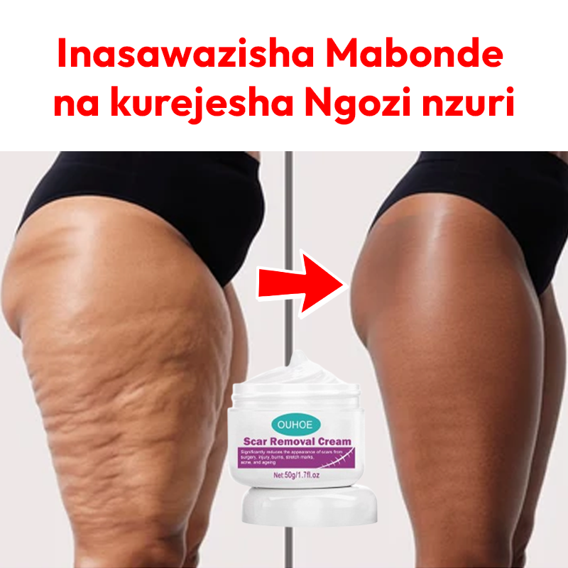 Scar Removal Cream 100% Natural + Guarantee
