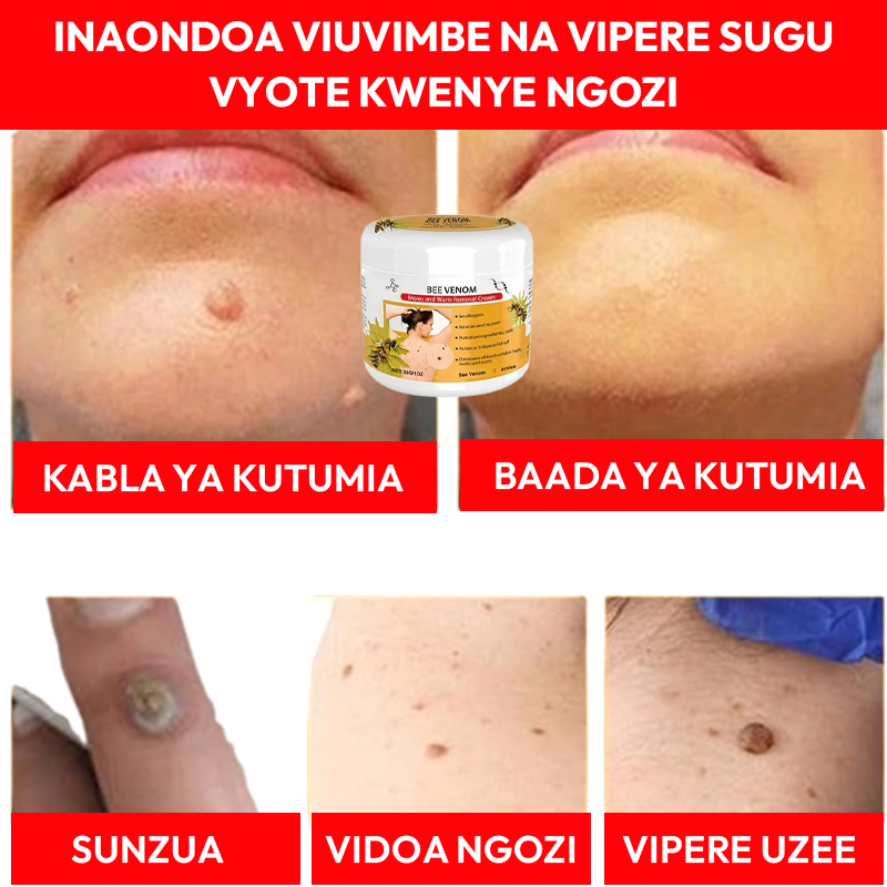 Warts Removal Cream 100% Natural
