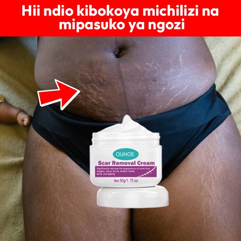 Scar Removal Cream 100% Natural + Guarantee