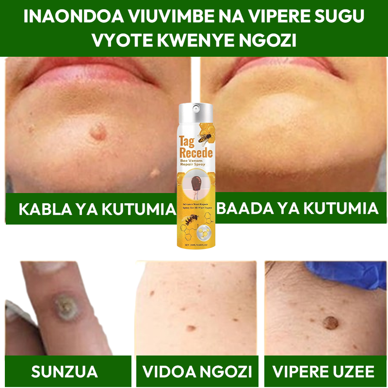 Warts Removal Spray