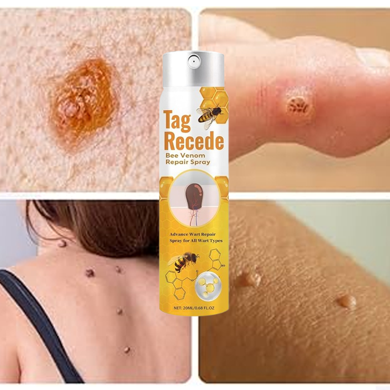 Warts Removal Spray