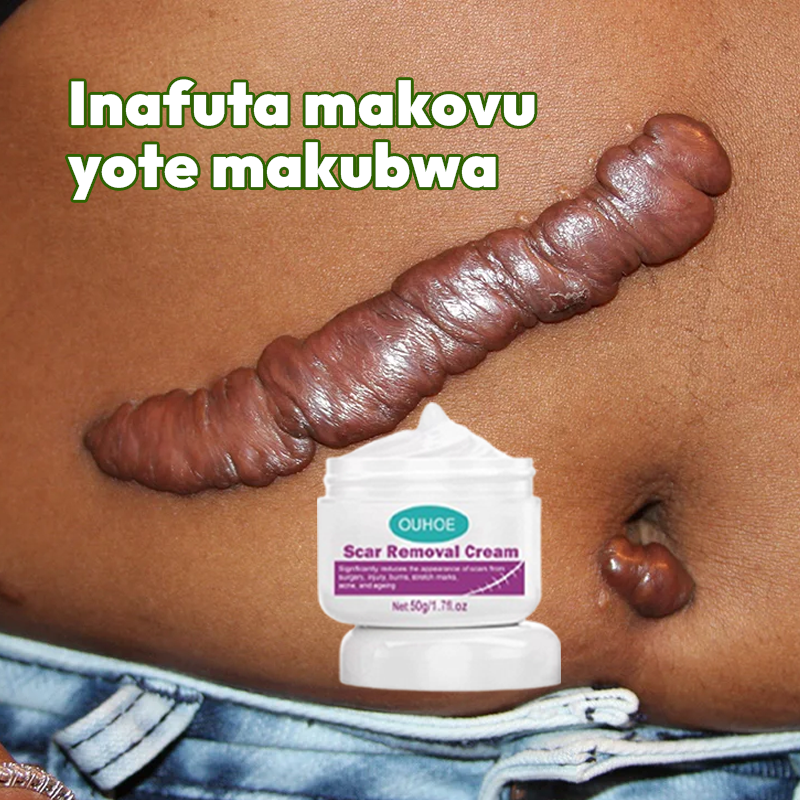 Scar Removal Cream 100% Natural + Guarantee
