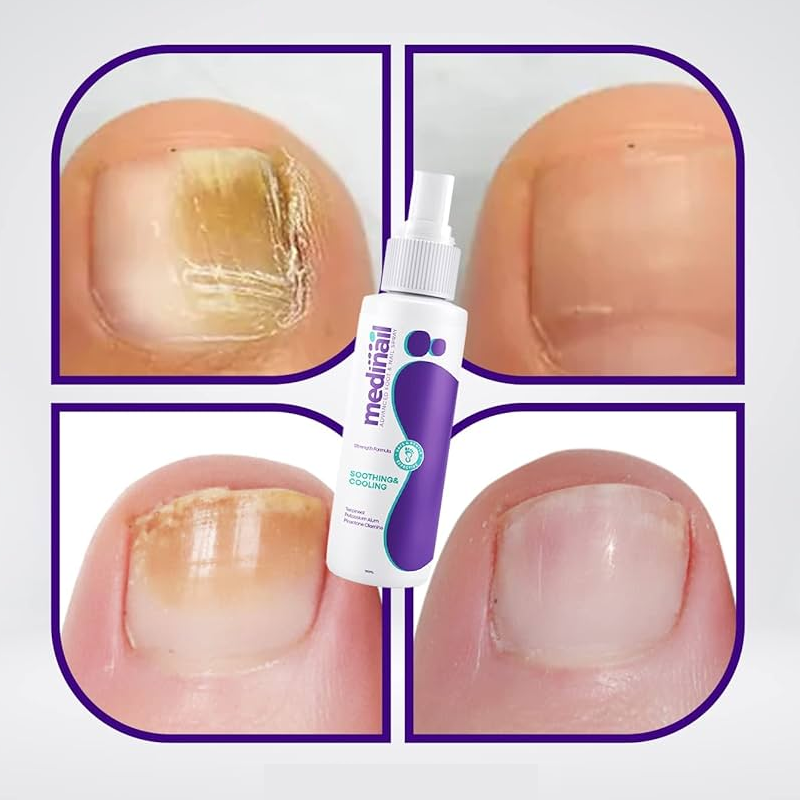 Nail Spray